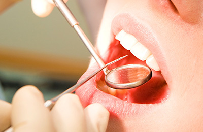 뽑기 전에, 한 번 더 살펴봅니다