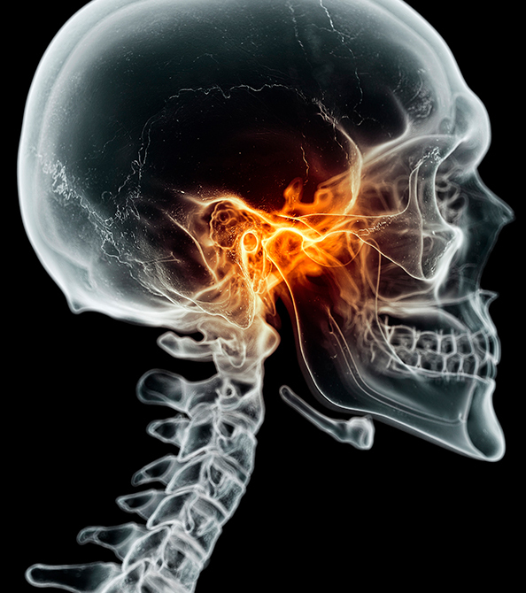 턱관절치료
