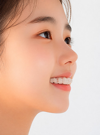 성장기교정